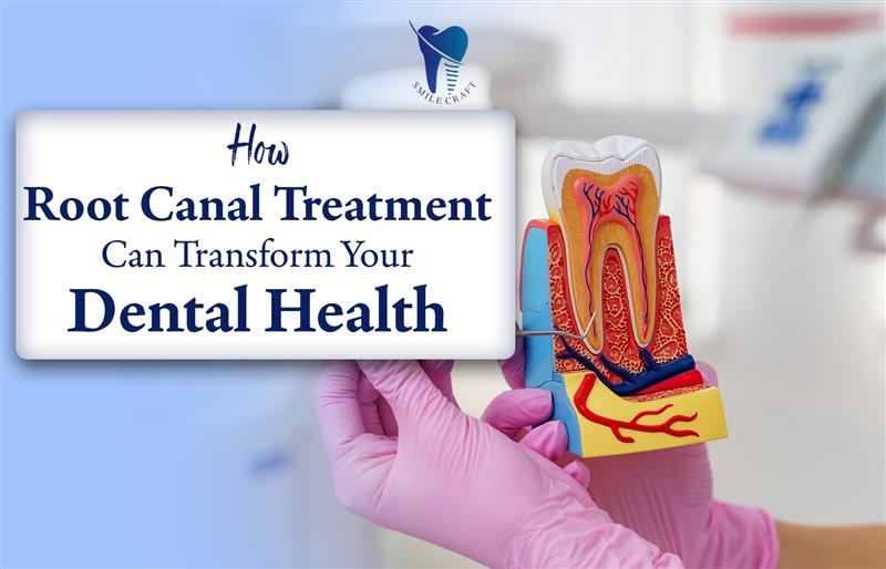 How Root Canal Treatment Can Transform Your Dental Health