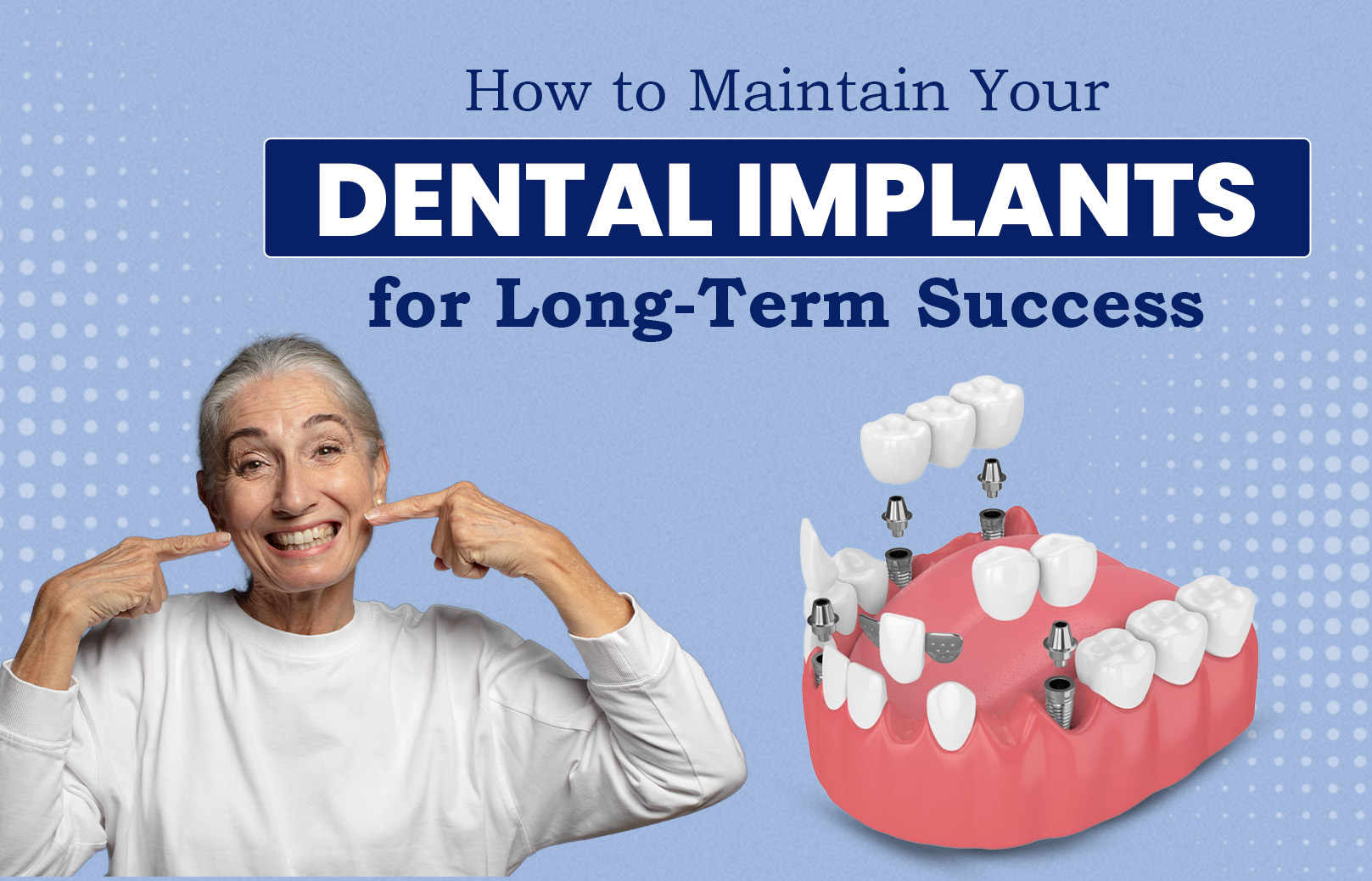 How to Maintain Your Dental Implants for Long-Term Success